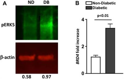 Retinal Inflammation, Oxidative Stress, and Vascular Impairment Is Ablated in Diabetic Mice Receiving XMD8-92 Treatment